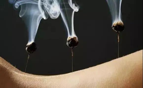 艾灸不是藥，調的不是病，央視為艾灸正名，讓我們正視艾灸
