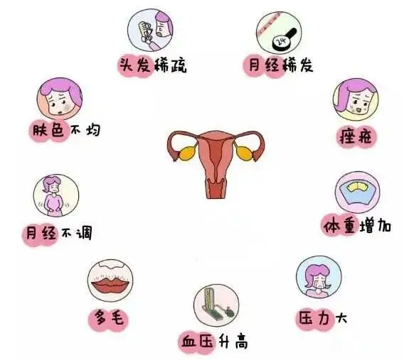 10個(gè)女人就有1個(gè)患多囊！被它纏上不要怕，艾灸幫你調(diào)“多囊”！